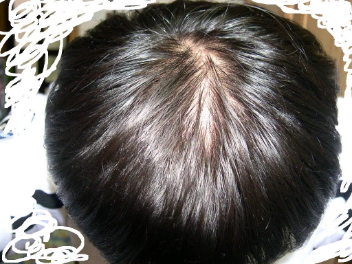 수술전1.JPG