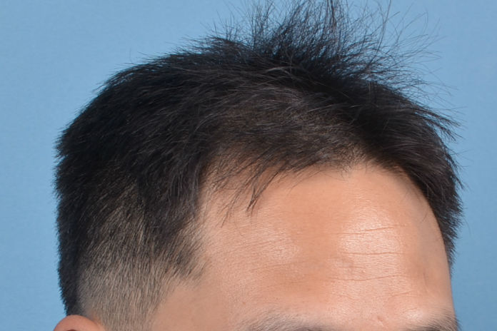 측면2.jpg