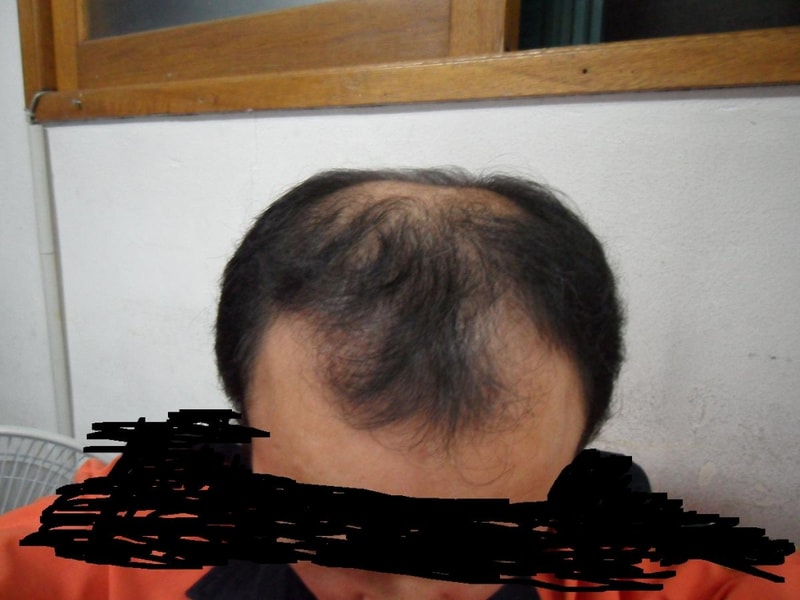 이마.JPG