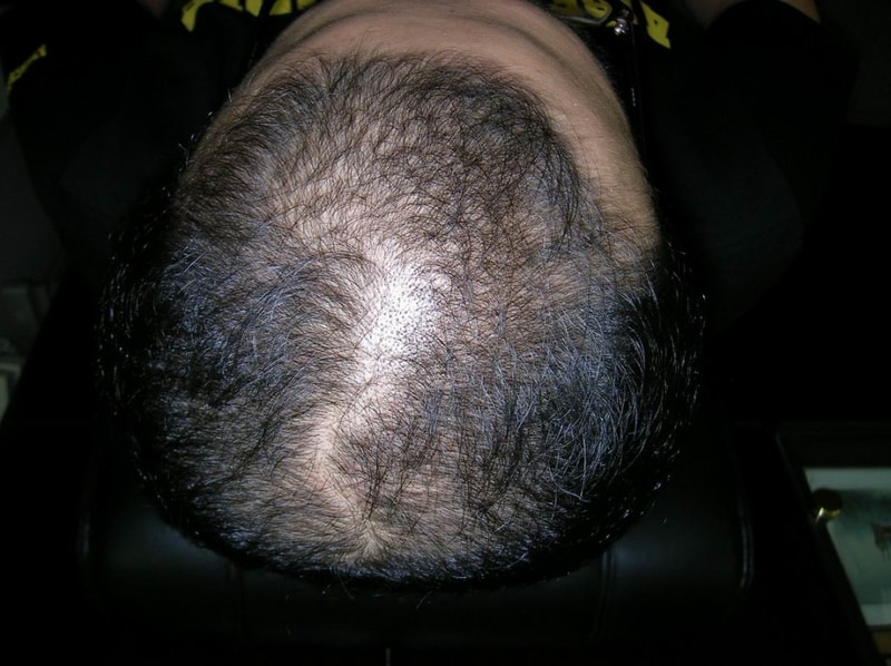 before.jpg