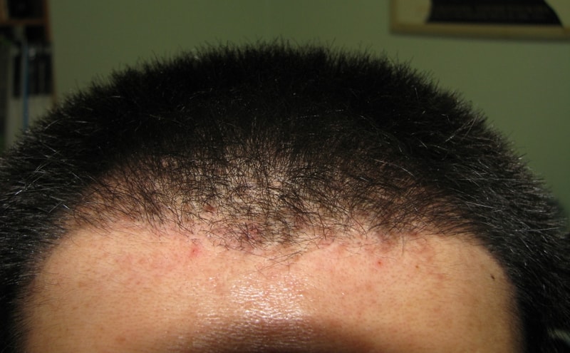 front head.jpg