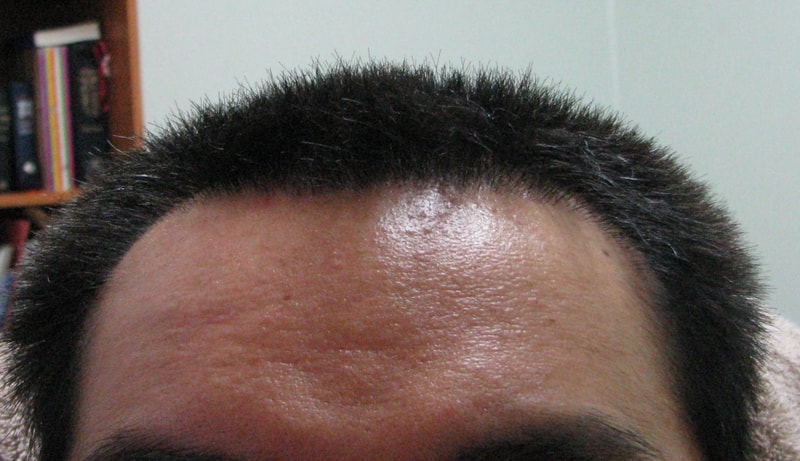 front head2.jpg
