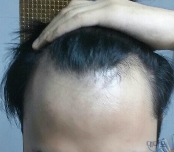 정면.jpg
