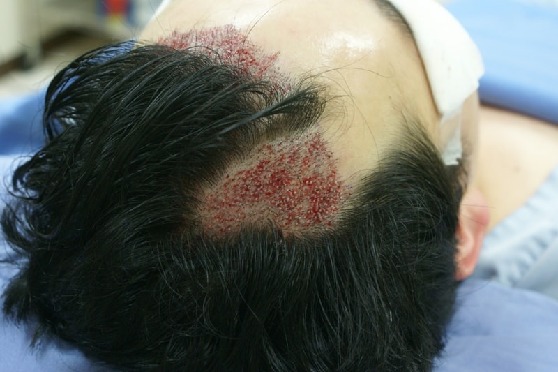 수술후2.JPG