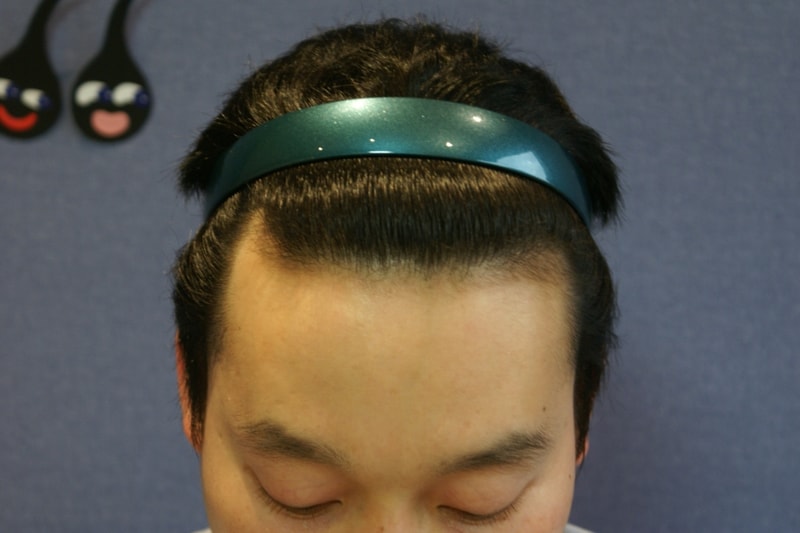 수술전1.JPG