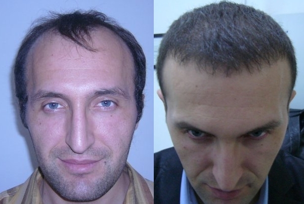 5.JPG
