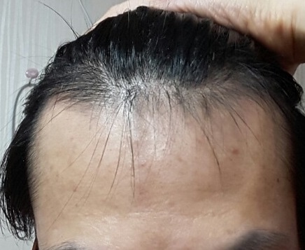 머리머리.jpg