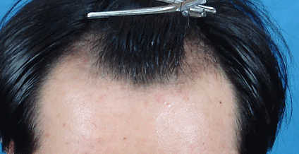 사본 - DSC03833.gif