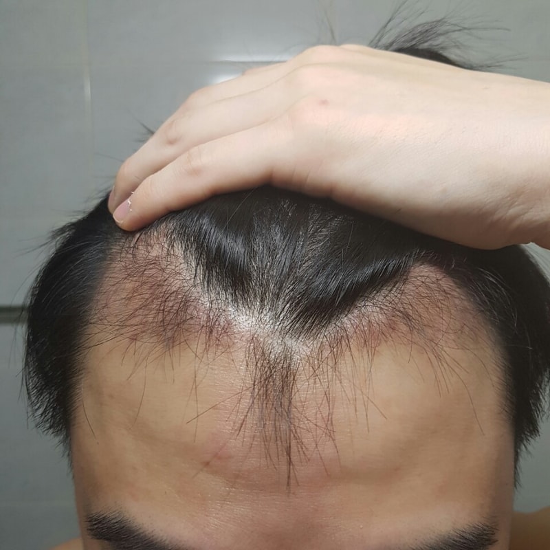 정면.jpg