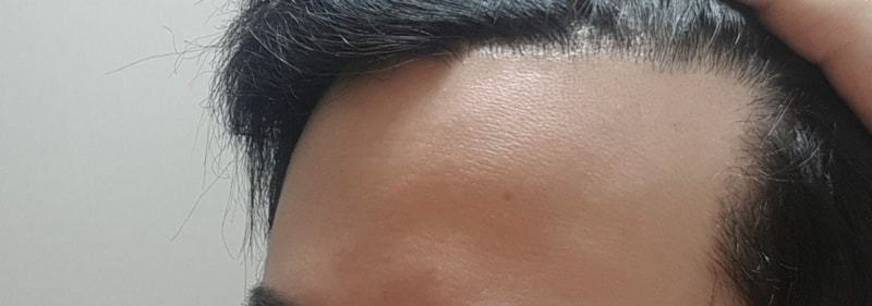왼쪽.jpg