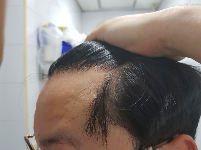 회전_크기변환_20180808_171226.jpg