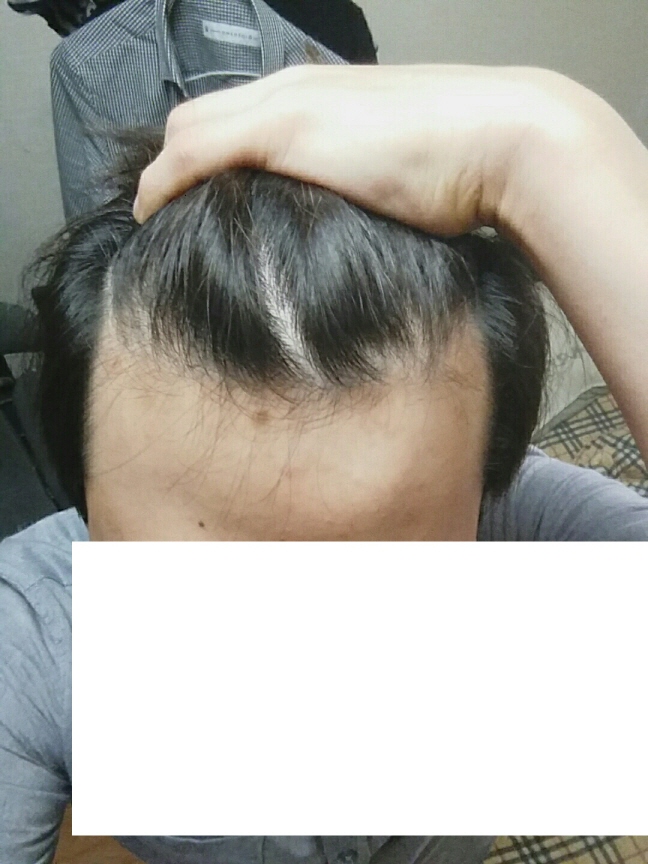 크기변환222_1전.jpg