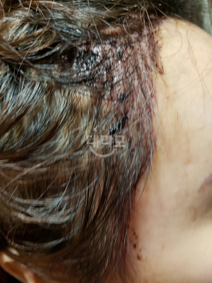 피딱지.jpg