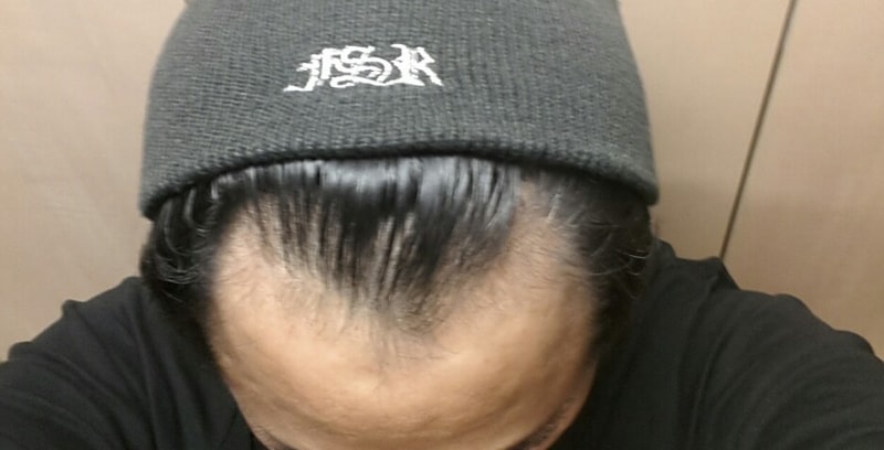 150107.jpg