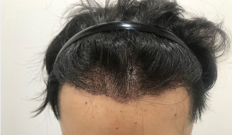 af2.PNG