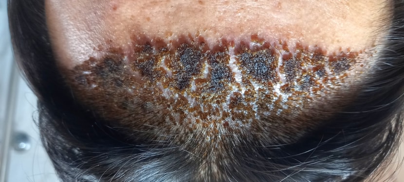 11일차