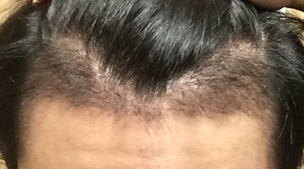 20151212_232136.png