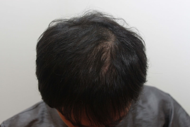 수술후.jpg