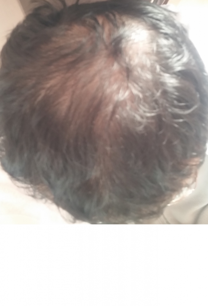 20170116.jpg