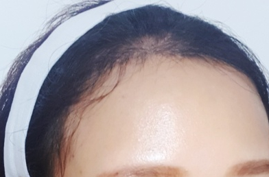 IMG_20180701_1.jpg