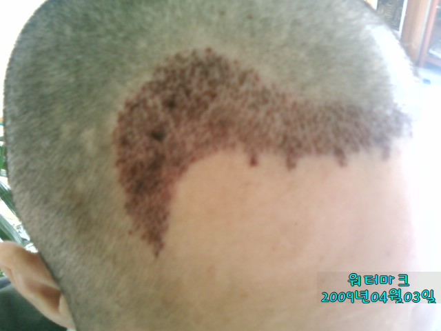 우.bmp