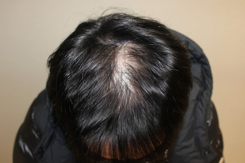 Before 2.jpg