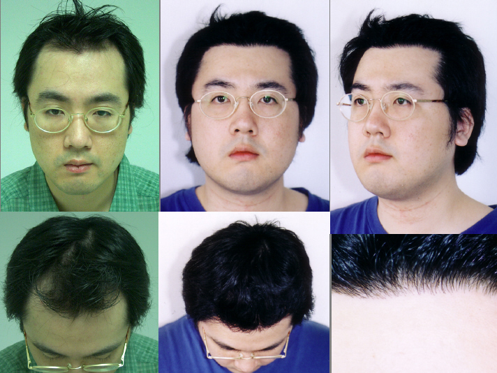 포맷변환_아시아 모델.jpg