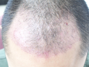 7.bmp