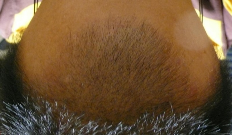 2mFront.JPG