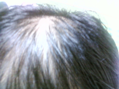 P100304002_2.png