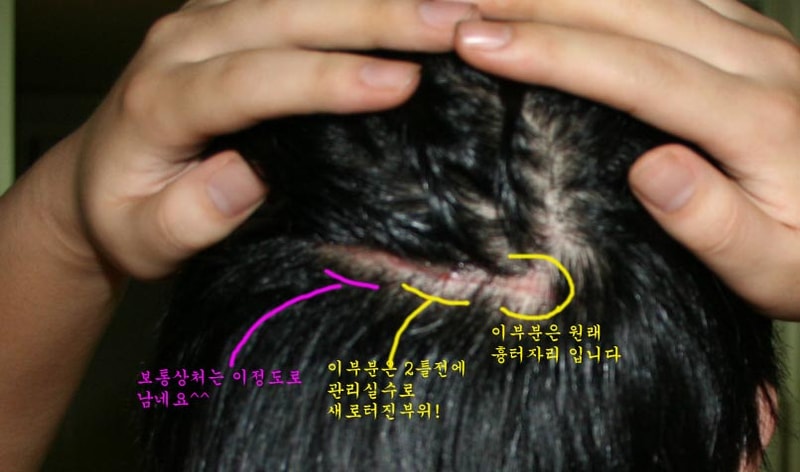 뒷머리.jpg