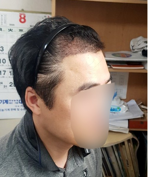 후2.PNG