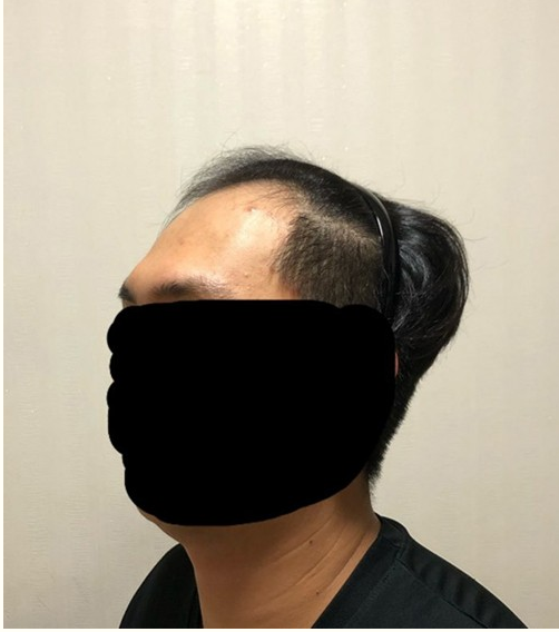 수술전