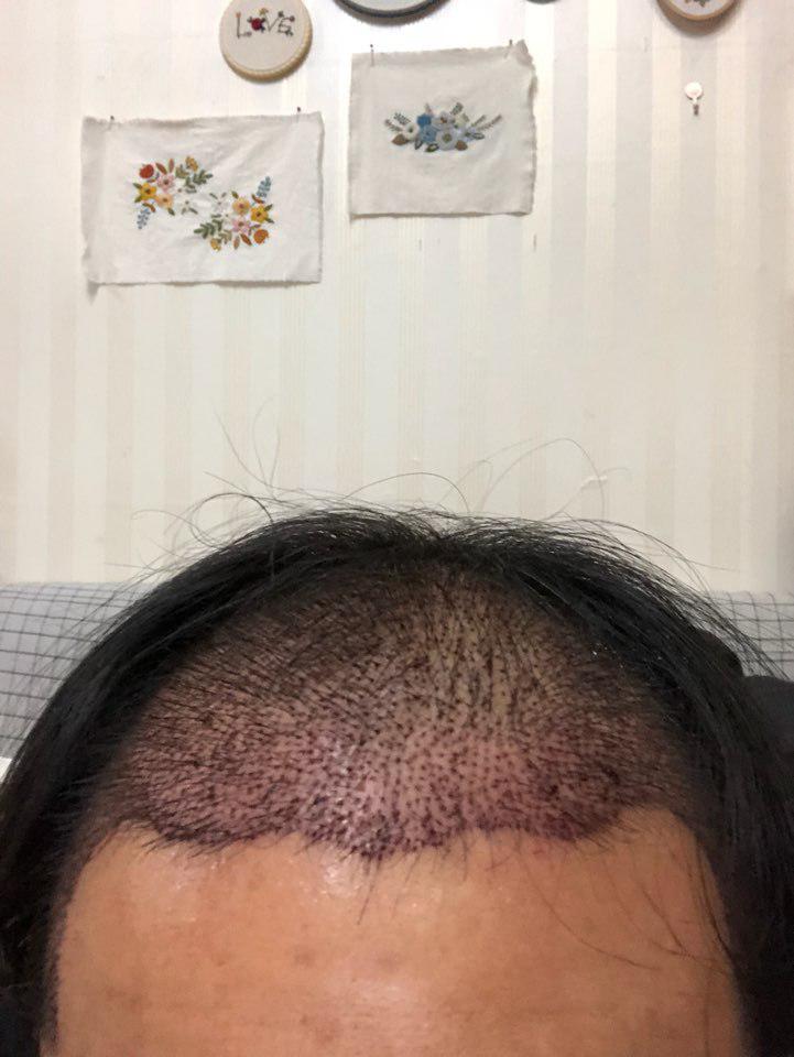 달랑이거시킨 (2).jpg