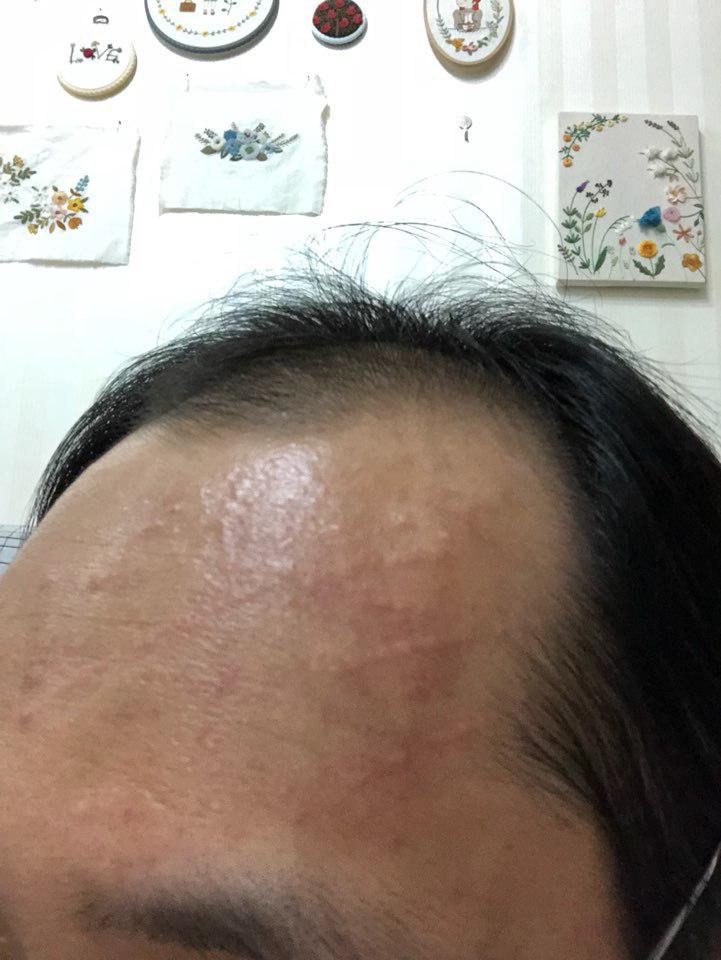 달랑이거시킨 (1).jpg