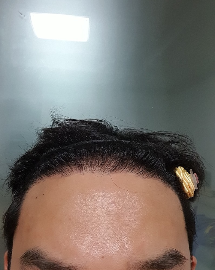 후2.PNG