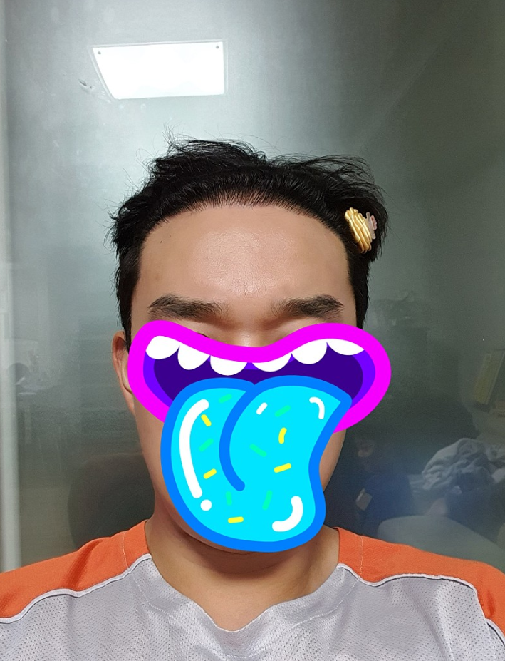 후1.PNG