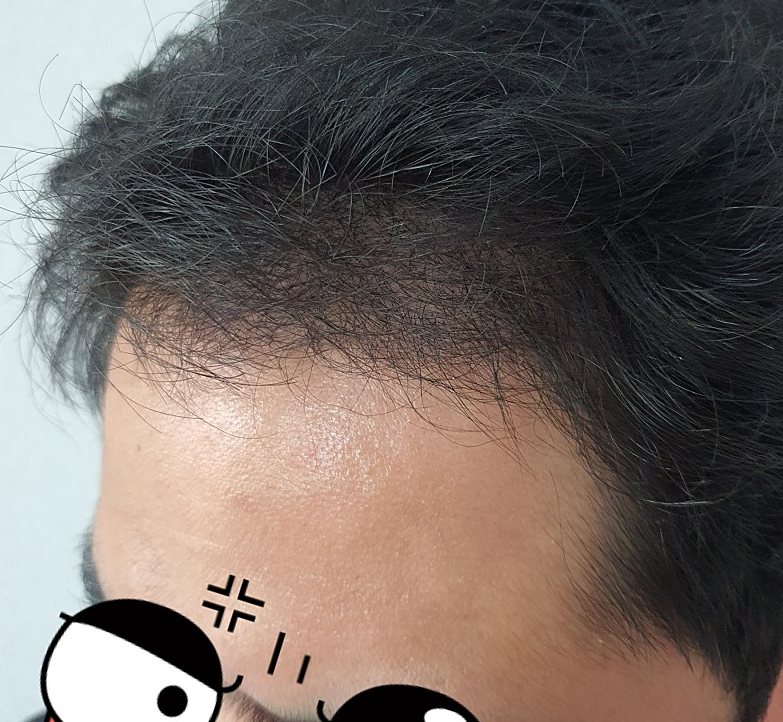 20200626 후 3.PNG