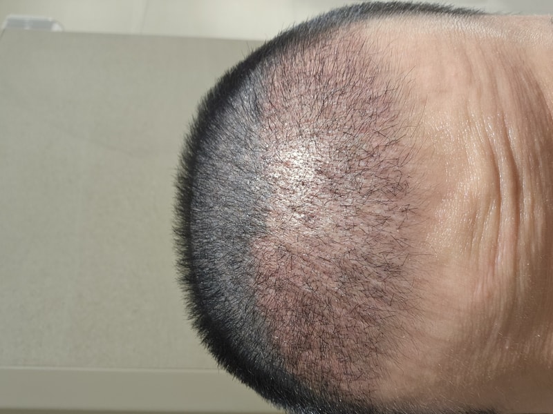1000015067.jpg