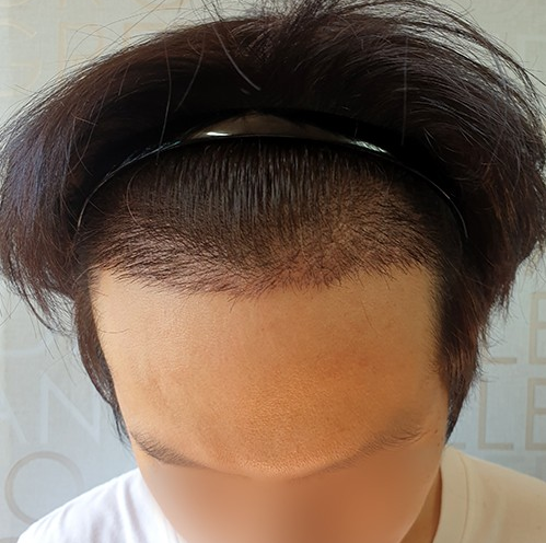 20200727 후 3.PNG