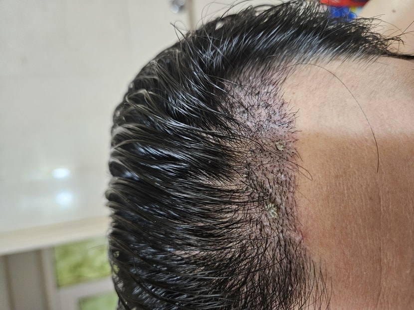 15일차 병원 방문후