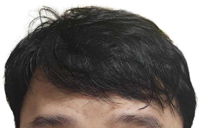 1000019596.png