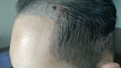 IMG_20171010_135657.jpg.jpg