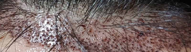 20170929_215506.jpg