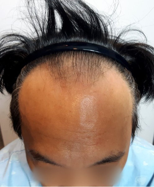 전1.PNG