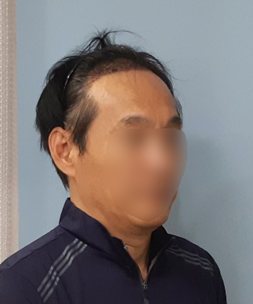 후2.PNG