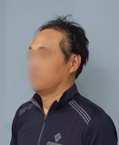 후1.PNG