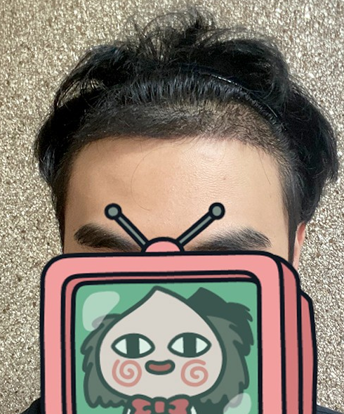 20200710 후 1.PNG