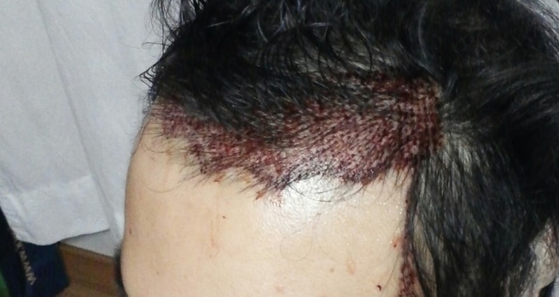 CROP_20160107_163526.JPG