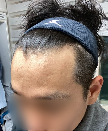 전.PNG